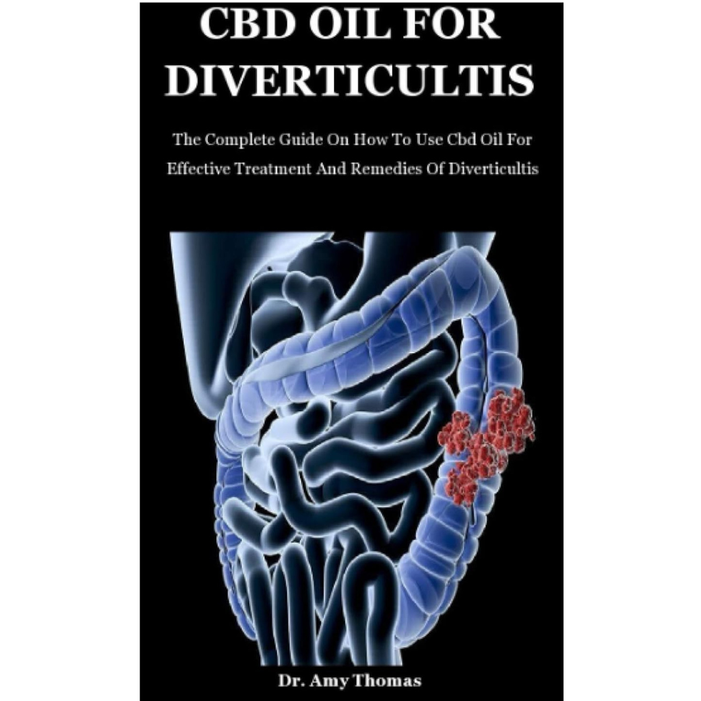 CBD oil for Divertivultis